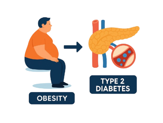 Understanding the Link Between Obesity and Type 2 Diabetes