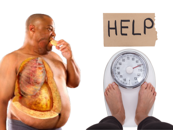 Bariatric Surgery in Delhi – Is It Safe? Risks, Recovery & Success Rates (2026 Guide)