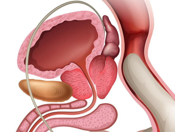 How Can I Reduce My Prostate Enlargement?