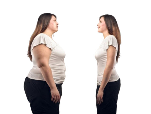 Bariatric Surgery in Delhi – Real Patient Success Stories & Transformations
