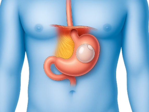 Weight Loss Ballooning Treatment in Delhi: Procedure, Benefits, and Cost