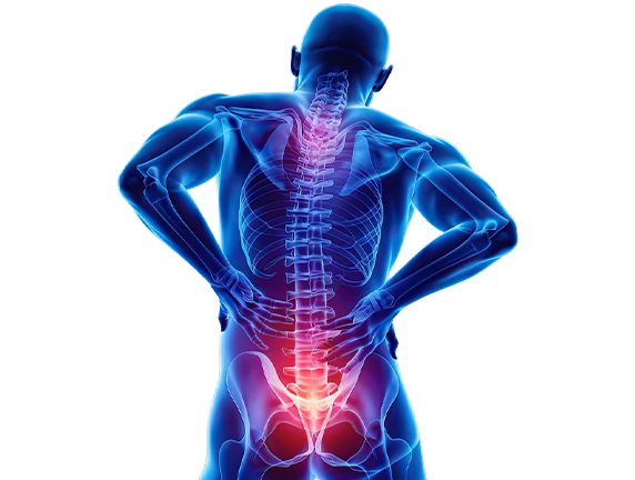 Neck Pain or Spondylitis? How to Treat Spondylitis at Home Naturally