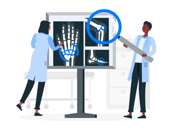 Managing Arthritis Naturally—What Actually Works?