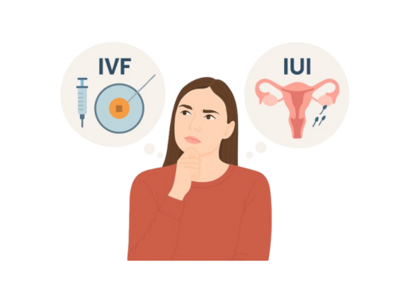 IVF vs IUI: Which Fertility Treatment Is Right for You?