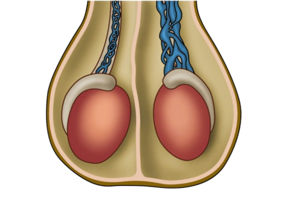 Varicocele Surgery in Delhi – How It Improves Fertility
