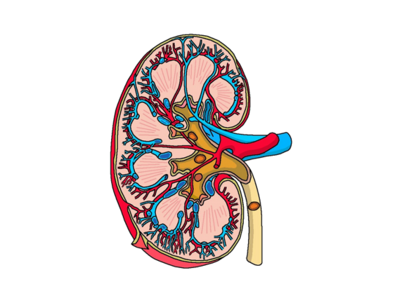Kidney Stones: What Size Requires Surgery?