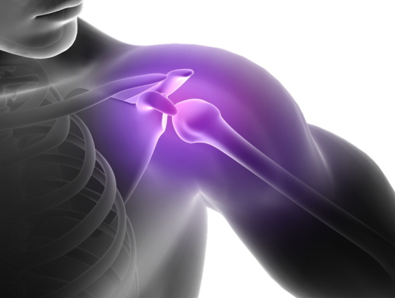 Handling a Dislocated Shoulder: Do’s and Don’ts