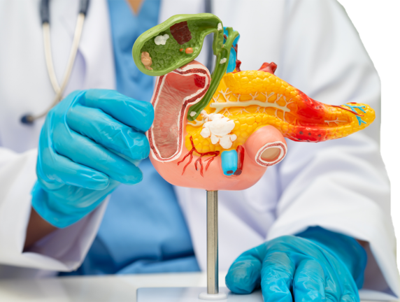 Gallstone Specialists Near You in South Delhi | Minimally Invasive Treatment