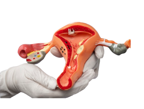 Laparoscopic Gynaecologist in South Delhi: Conditions Treated, Procedures & Costs